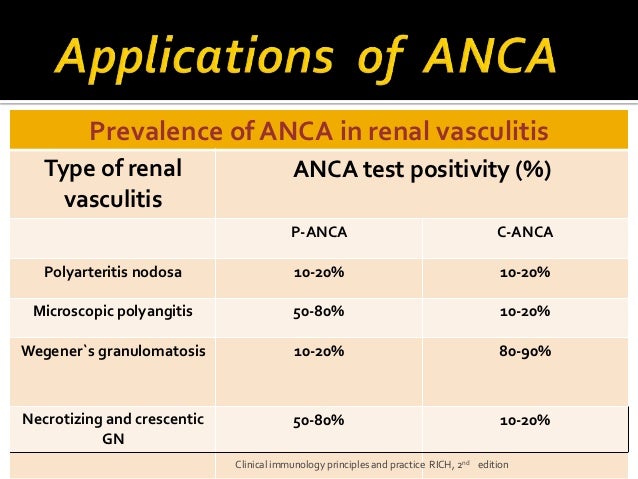 p anca polyarteritis nodosa